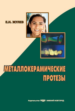Металокерамические протезы: руководство